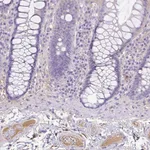 Atlas Antibodies Anti-CLEC3B Antibody