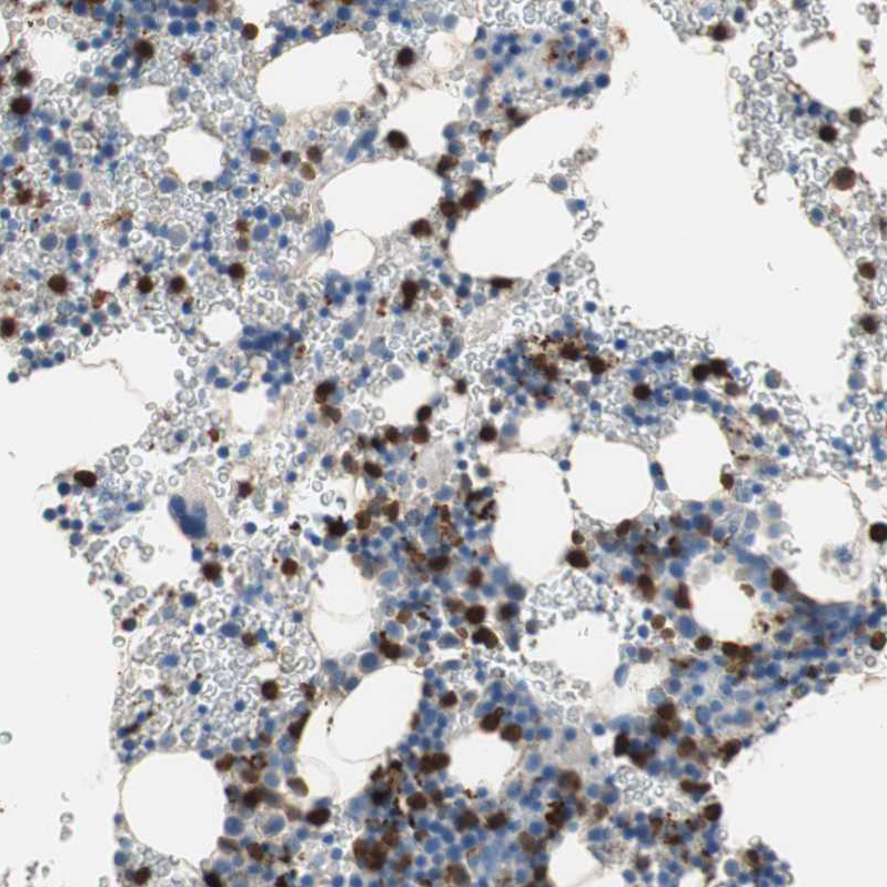 Atlas Antibodies Anti-CLEC4D Antibody
