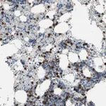 Atlas Antibodies Anti-CLEC4D Antibody