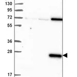 Atlas Antibodies Anti-CLEC7A Antibody