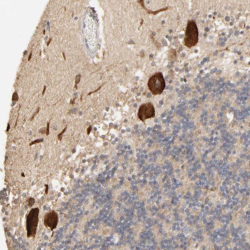 Atlas Antibodies Anti-CLEC4E Antibody