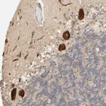 Atlas Antibodies Anti-CLEC4E Antibody