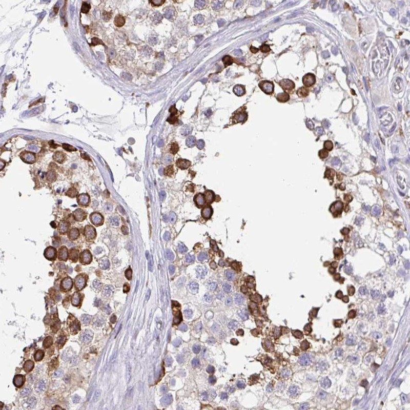 Atlas Antibodies Anti-CLGN Antibody