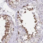 Atlas Antibodies Anti-CLGN Antibody