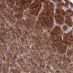 Atlas Antibodies Anti-CLHC1 Antibody