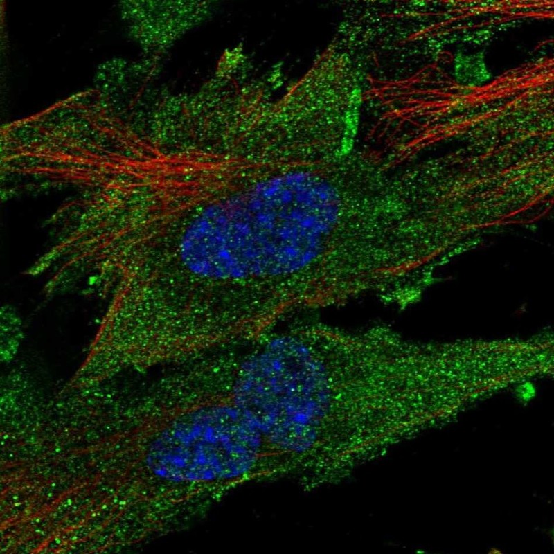 Atlas Antibodies Anti-CLIC2 Antibody