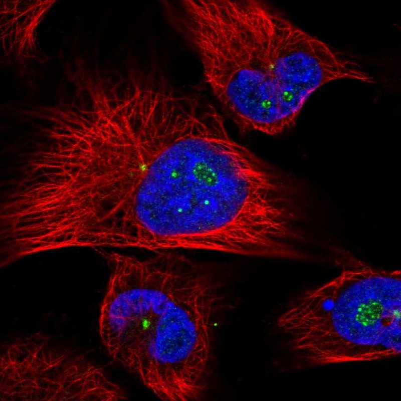 Atlas Antibodies Anti-CLHC1 Antibody