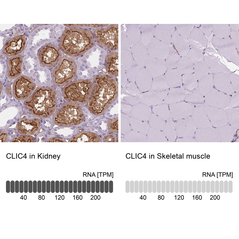 Atlas Antibodies Anti-CLIC4 Antibody