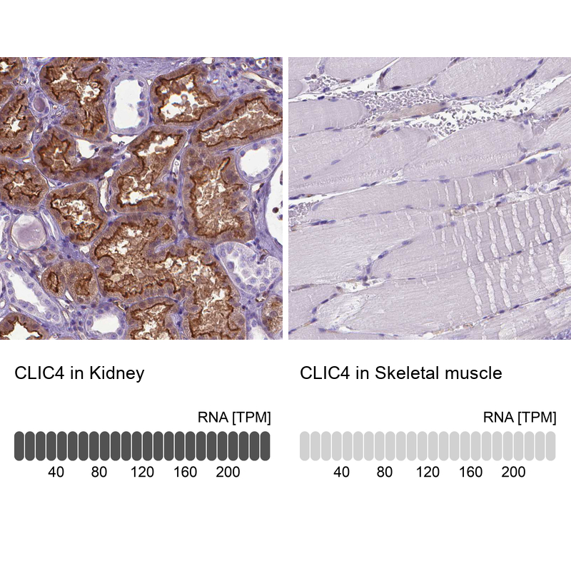 Atlas Antibodies Anti-CLIC4 Antibody