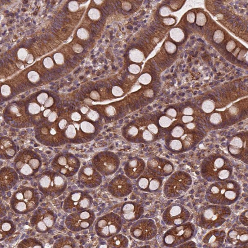 Atlas Antibodies Anti-CLINT1 Antibody