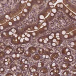 Atlas Antibodies Anti-CLINT1 Antibody