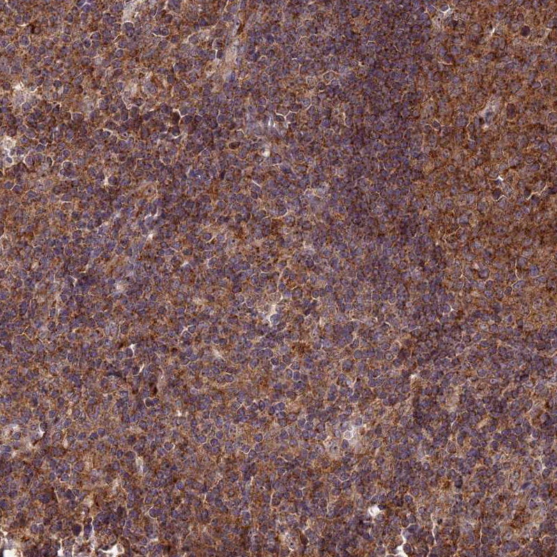 Atlas Antibodies Anti-CLINT1 Antibody