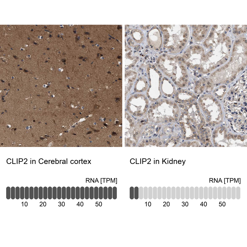Atlas Antibodies Anti-CLIP2 Antibody