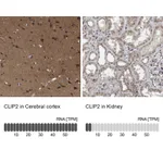 Atlas Antibodies Anti-CLIP2 Antibody