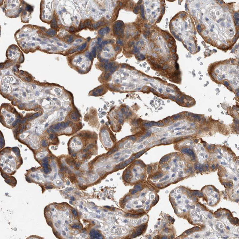 Atlas Antibodies Anti-CLIP1 Antibody