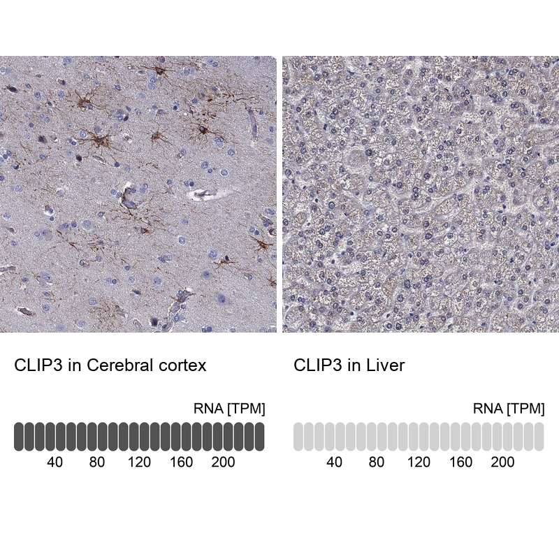 Atlas Antibodies Anti-CLIP3 Antibody