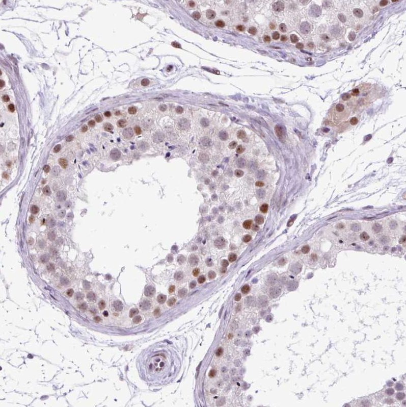 Atlas Antibodies Anti-CLK2 Antibody