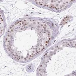 Atlas Antibodies Anti-CLK2 Antibody