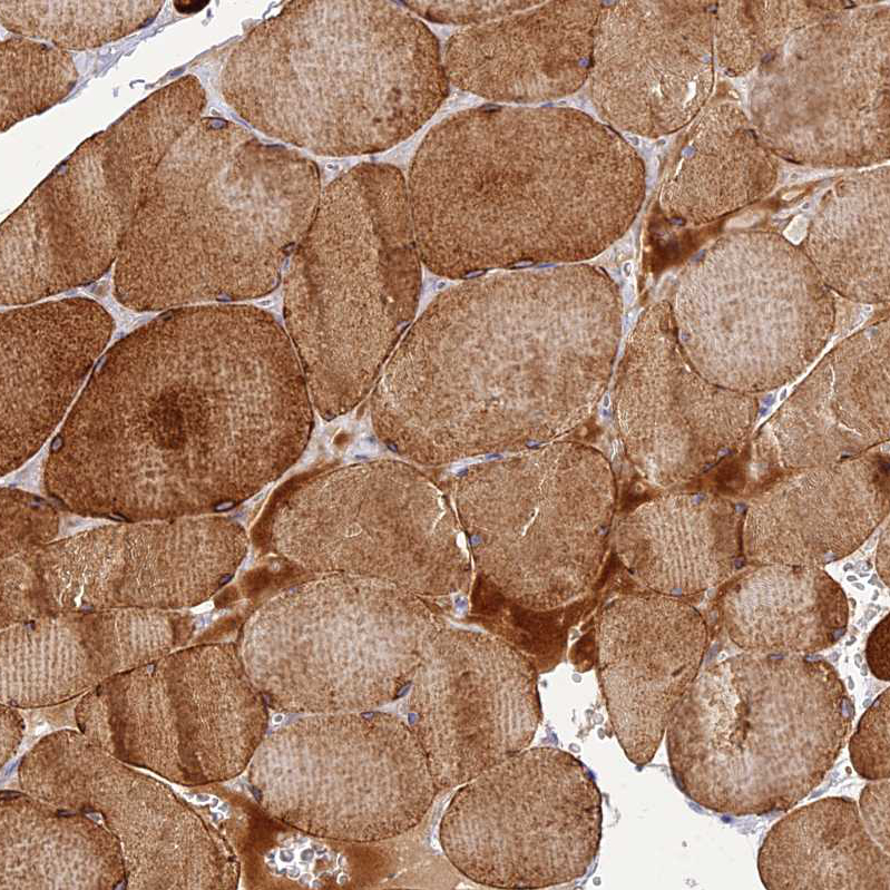 Atlas Antibodies Anti-CLIP4 Antibody