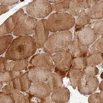 Atlas Antibodies Anti-CLIP4 Antibody