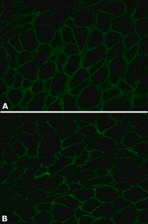 Merck Anti-Dystrophin antibody, Mouse monoclonal