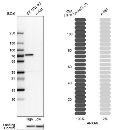 Merck Anti-ANXA6 antibody produced in rabbit