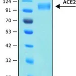 Merck ANGIOTENSIN CONVERTING ENZYME-2, ACE2