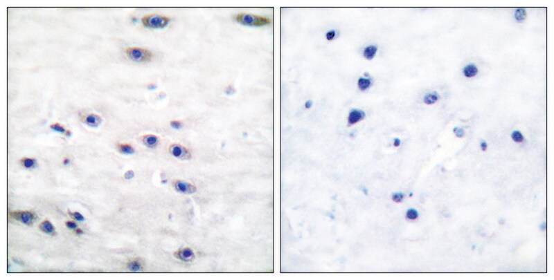 Merck Anti-Tyrosine Hydroxylase, N-Terminal antibody produced in rabbit
