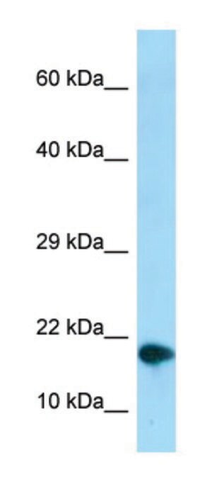 Merck ANTI-NUPR1 (C-TERMINAL) ANTIBODY PRODUCE