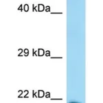 Merck ANTI-NUPR1 (C-TERMINAL) ANTIBODY PRODUCE