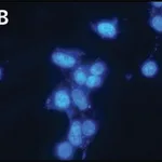 Merck Anti-XPG (C-terminal) antibody produced in rabbit