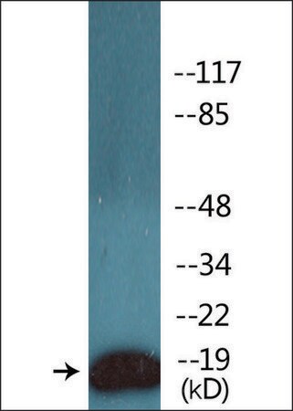 Merck Anti-phospho-CD3 zeta (pTyr142) antibody produced in rabbit