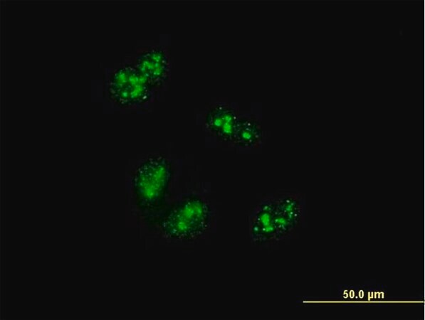 Merck Monoclonal Anti-TCOF1 antibody produced in mouse