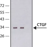 Merck Anti-CTGF antibody, Mouse monoclonal