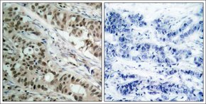 Merck ANTI-FOXO1 (AB-256)