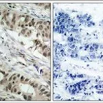 Merck ANTI-FOXO1 (AB-256)