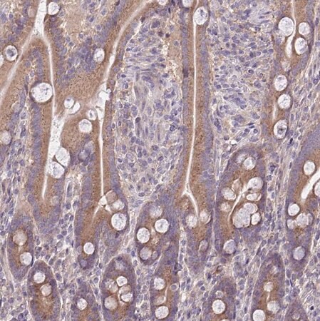 Merck Anti-CEACAM18 antibody produced in rabbit