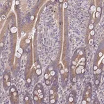 Merck Anti-CEACAM18 antibody produced in rabbit