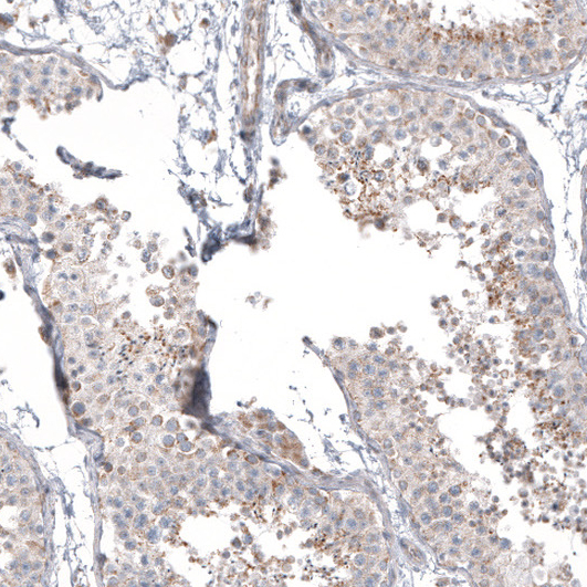 Atlas Antibodies Anti-PPM1J Antibody