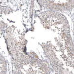 Atlas Antibodies Anti-PPM1J Antibody