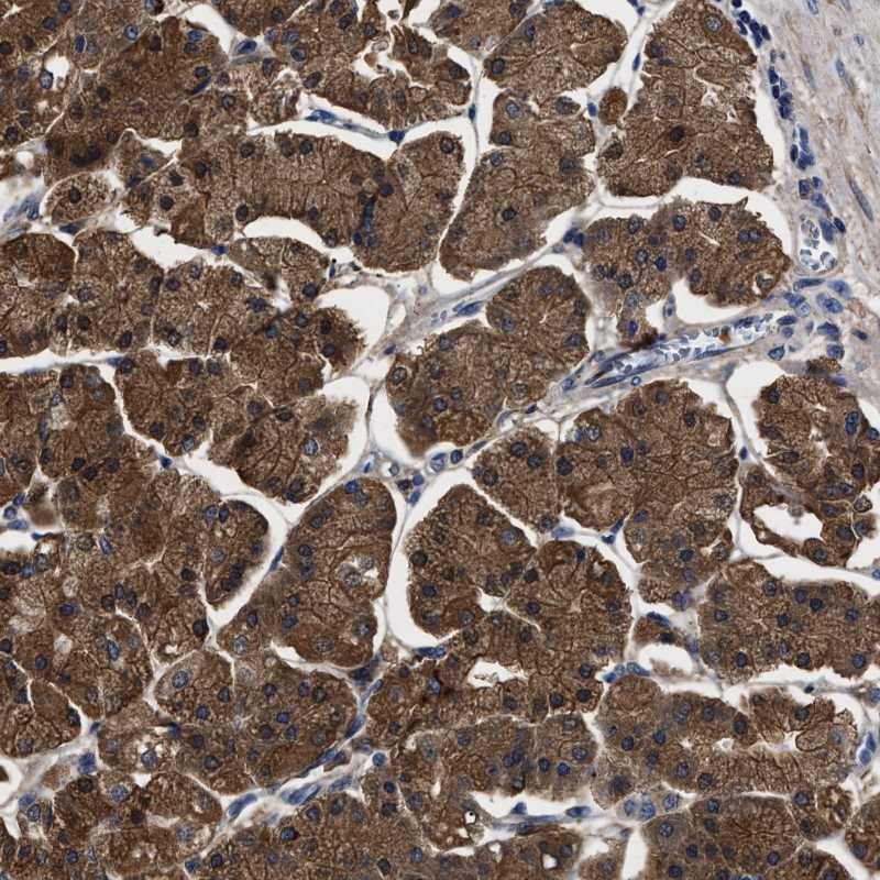 Atlas Antibodies Anti-PPM1K Antibody