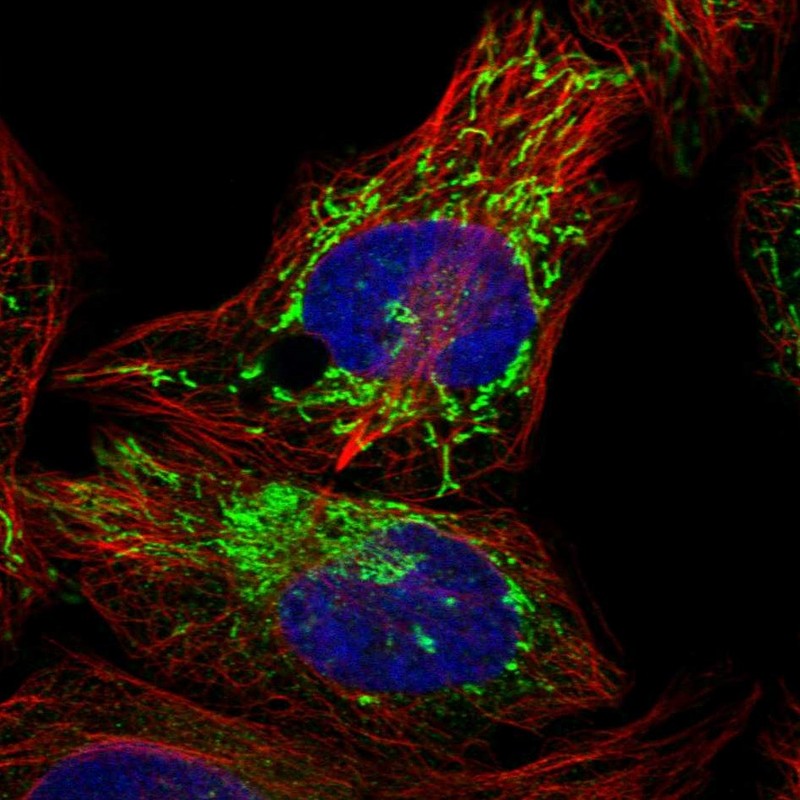 Atlas Antibodies Anti-PPM1K Antibody