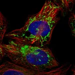 Atlas Antibodies Anti-PPM1K Antibody