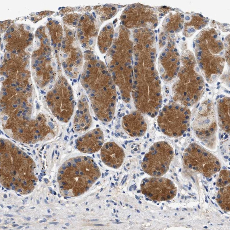 Atlas Antibodies Anti-PPM1L Antibody