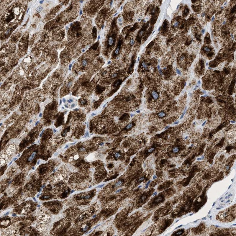 Atlas Antibodies Anti-PPM1L Antibody