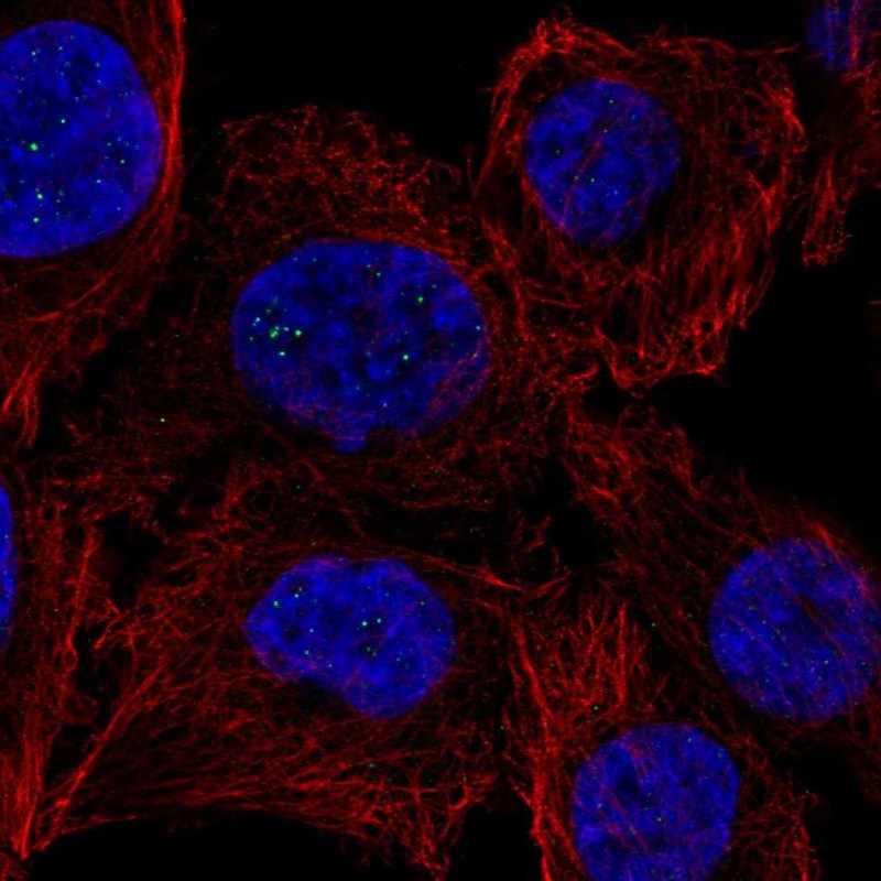 Atlas Antibodies Anti-PPM1M Antibody