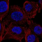 Atlas Antibodies Anti-PPM1M Antibody