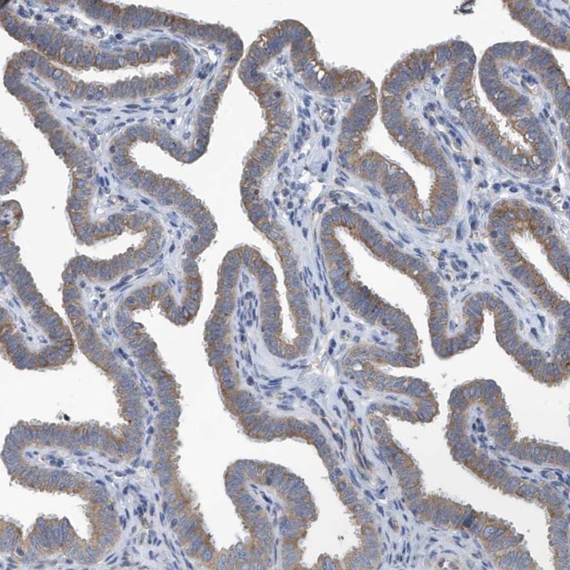 Atlas Antibodies Anti-PPM1M Antibody