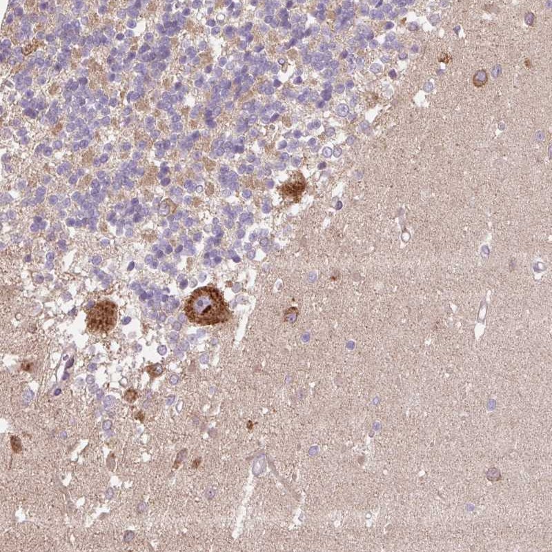 Atlas Antibodies Anti-PPME1 Antibody