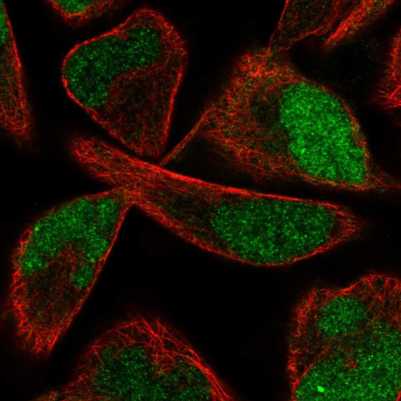 Atlas Antibodies Anti-PPME1 Antibody